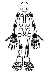 Figure. 28 Joint Exam - darkened joints are examined and recorded as TJC =  XX/28 or SJC = XX/28